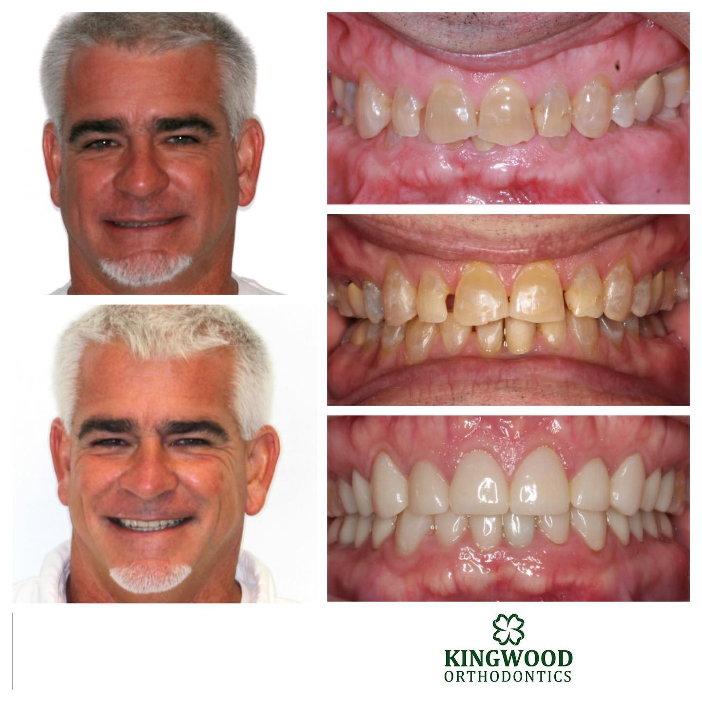 before and after images of patient