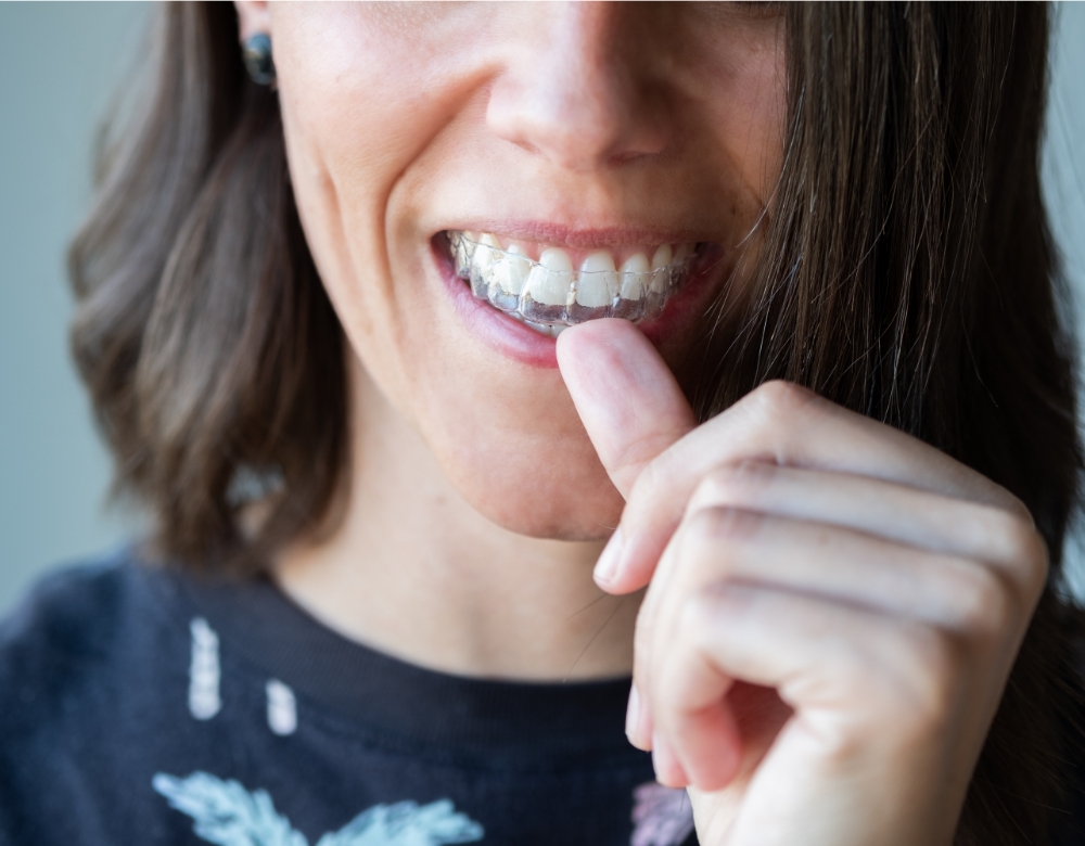 woman putting invisalign tray in her mouth